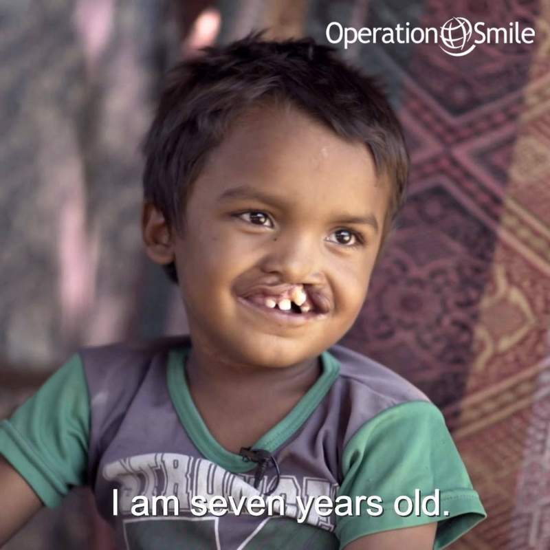 Operation Smile Facebook ad
